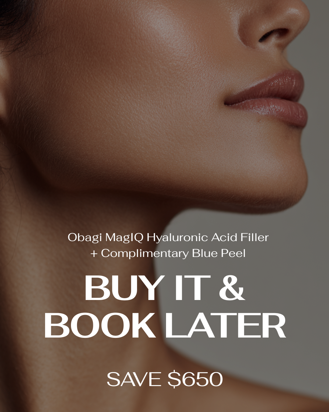 NEW | Obagi MagIQ HA Filler + Complimentary Blue Peel