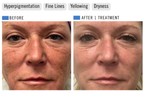 The Healthy Summer Peel
