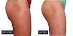Secret Sale - Venus Body - 3 Treatments