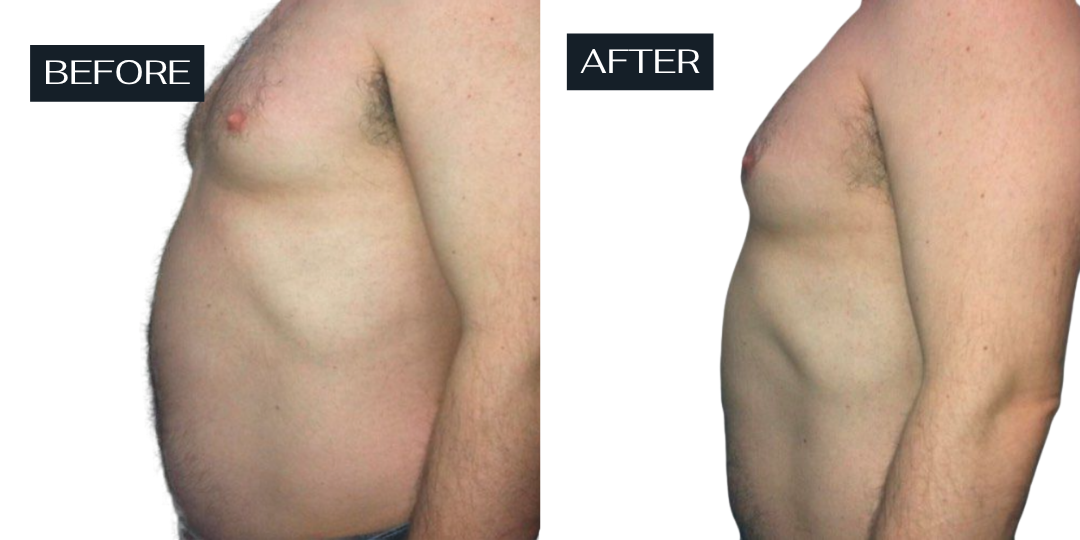 Secret Sale - Venus Body - 3 Treatments