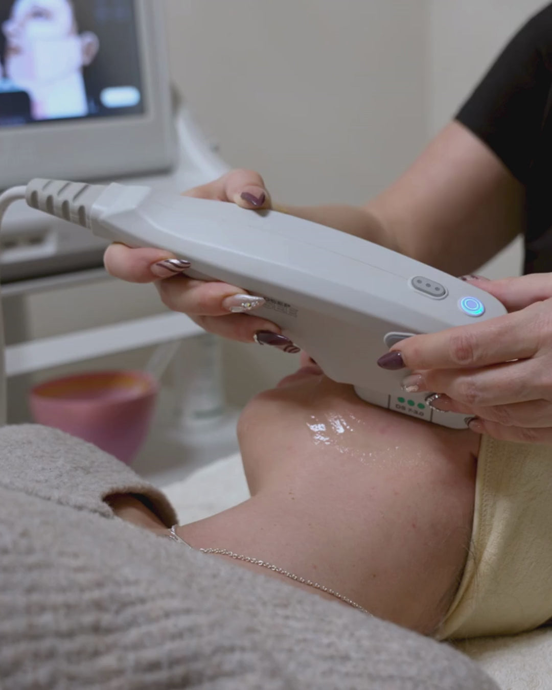 Venus Skin Tightening (Eyes/Face)